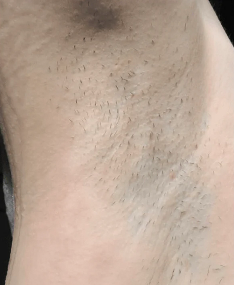 Before Image