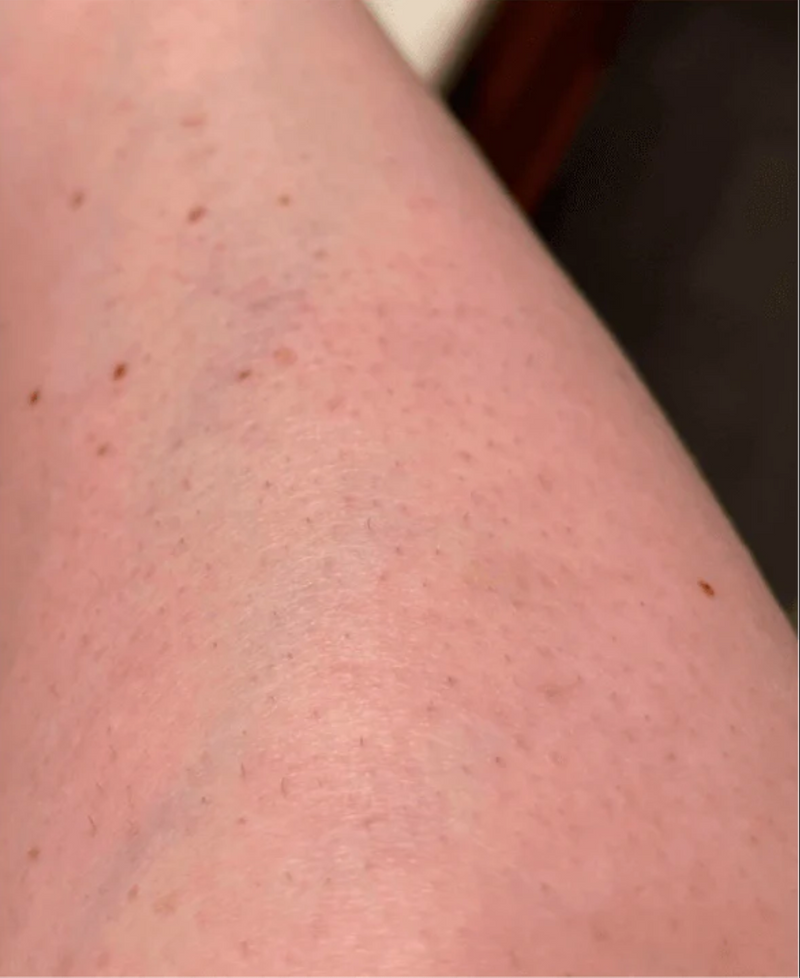 After Image