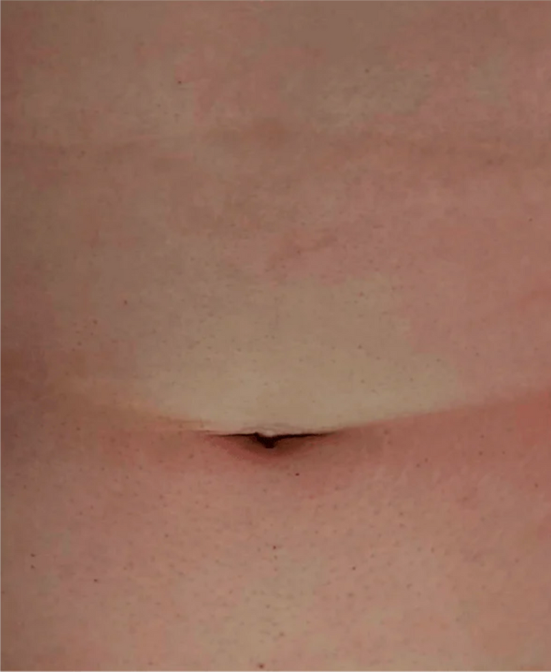 After Image