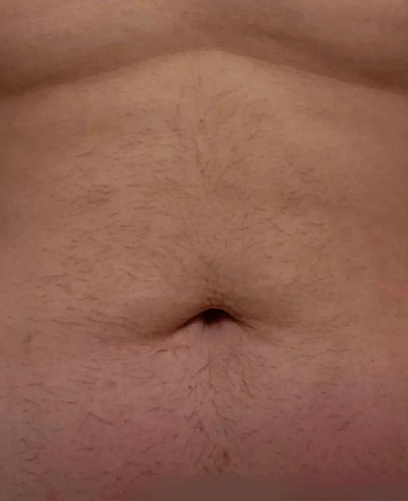 Before Image